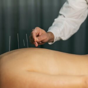 Certificación en Punción Seca y Electropunción